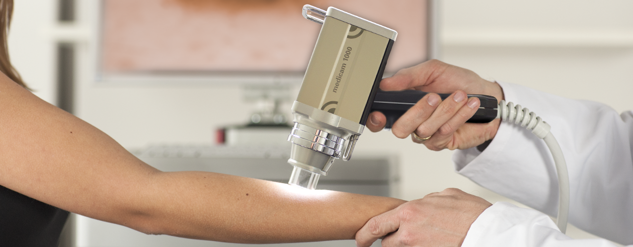 videodermatoscopia La visita dermatologica Genova – Poliambulatorio Liguria
