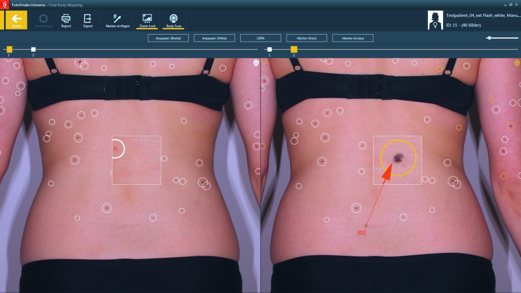 Mappa dei Nei a Genova - Totalbody Photography Il quadrilatero Genova