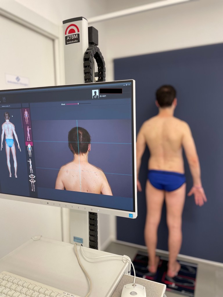 Mappatura Nei - Mappa dei nei Genova Liguria Totalbody Photography 