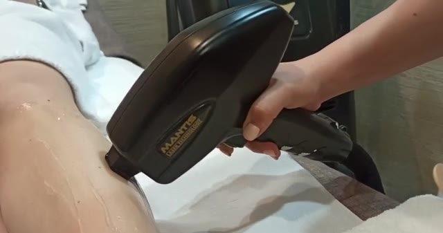 Black Mamba epilazione laser